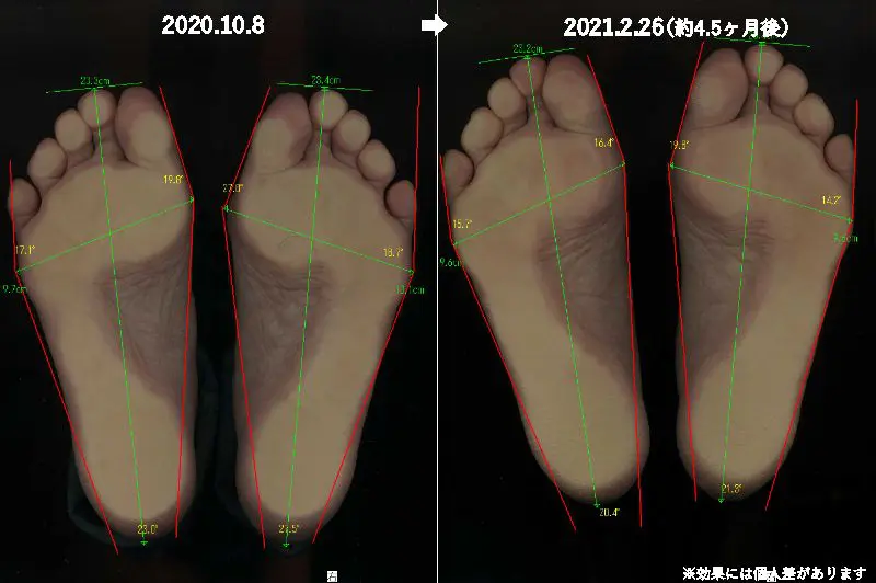 2021.2.26Yビフォアーアフター＋